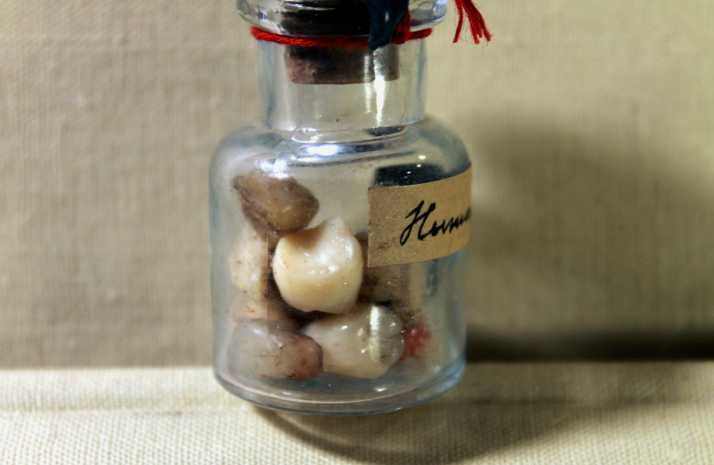 Human teeth -closeup